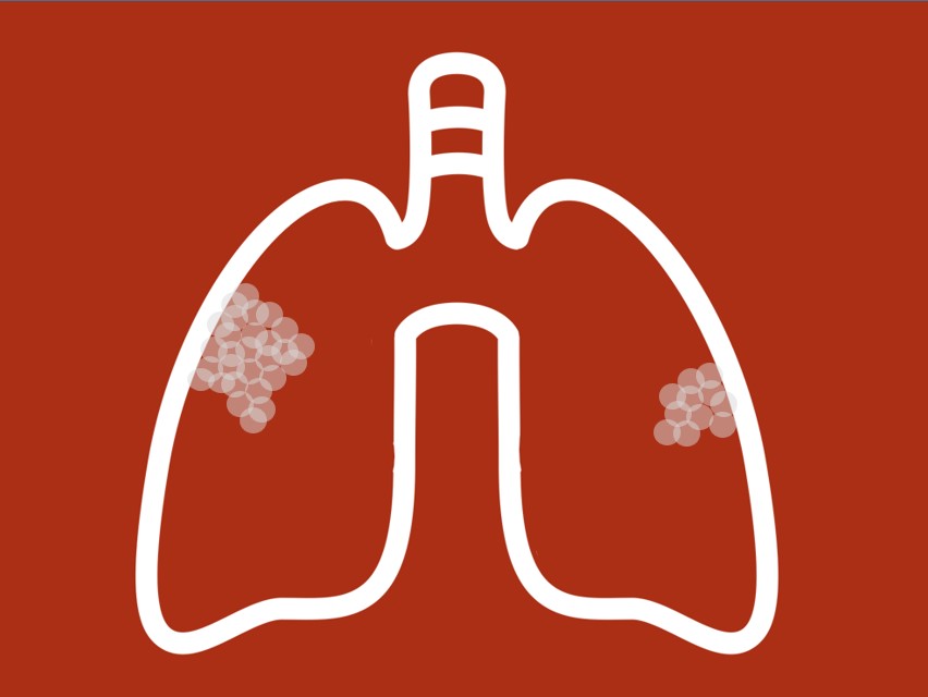 icon of lung with disease