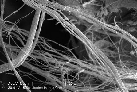 Asbestos under microscope