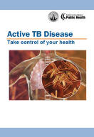 Active TB