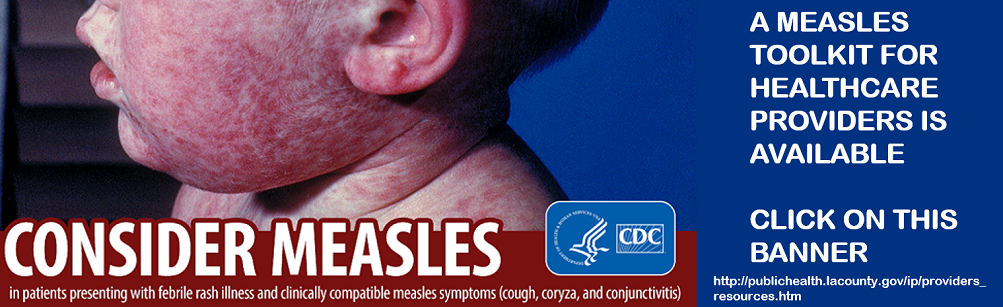 Consider measles in patients presenting with febrile rash and clnically compatible measles symptoms (cough, coryza, and conjunctivitis). A measles toolkit for healthcare providers is available. http://publichealth.lacounty.gov/ip/providers_resources.htm